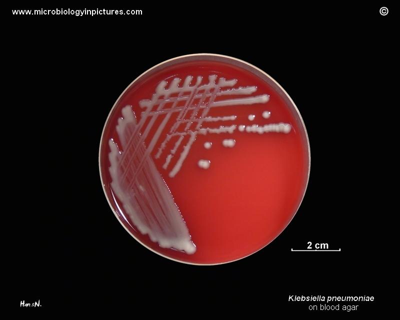 klebsiella-pneumoniae-on-blood-agar-plate-k-pneumoniae-bacteria